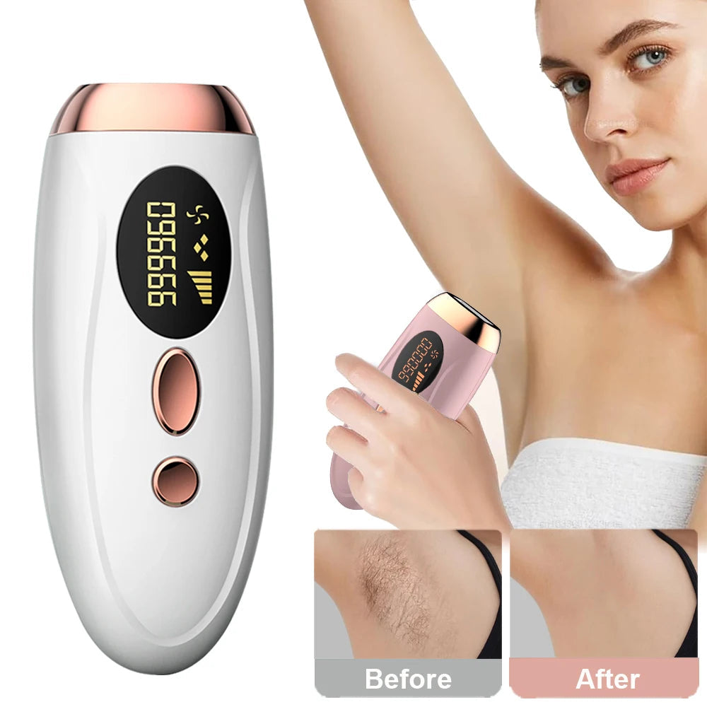AllLadyShop™ IPL Laser Hair Removal Handset - Professional At-Home Solution