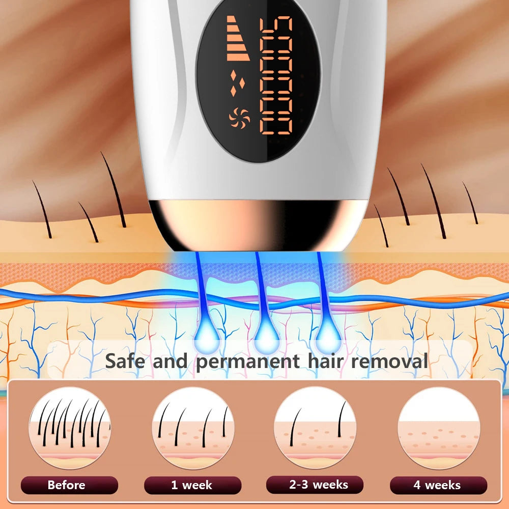 AllLadyShop™ IPL Laser Hair Removal Handset - Professional At-Home Solution